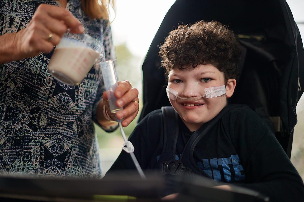 A young boy being tube fed